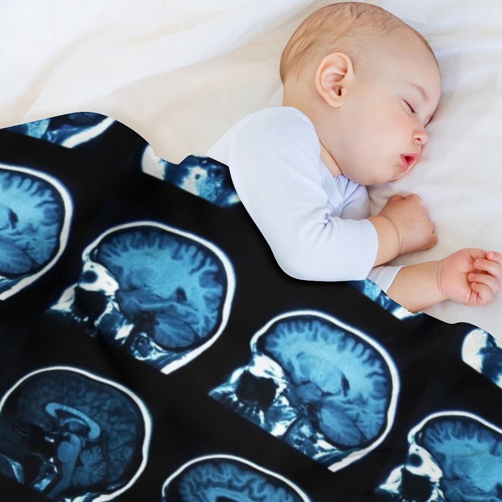 Brain MRI x-ray Throw Blanket  - đánh giá và giá 3D Printing X Ray